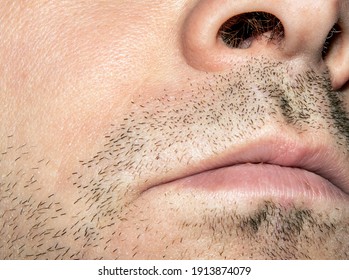 Unshaven Stubble On The Male Face Around The Lips.