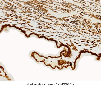 Unstained ciliary body showing location of melanin in the stroma and the ciliary epithelium. The clear spaces visible in the stroma belong to the ciliary muscle, responsible for the accommodation