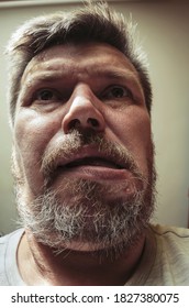 Unusual Portrait Of An Adult Bearded Man. A 44 Year Old Man With A Beard Grimaces In Front Of The Camera. Close-up. Selective Focus.