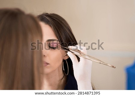 Upper blepharoplasty planning involves a surgeon showing the exact tissue removal area on the face of a female patient for aesthetic improvement.