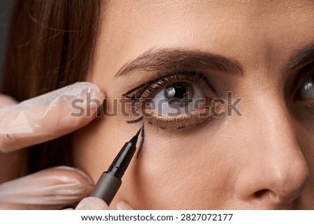 Upper blepharoplasty precise flap outline drawing closed eyelid female patient skin excision marking surgeon hands transparent gloves.