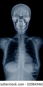 Upper Body Part X-ray Image 