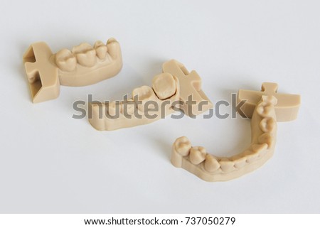  Upper and lower jaws dental bridge printed on 3D printer from a photopolymer material  on white background Stereolithography 3D printer, technology of liquid photopolymerization under UV light.
