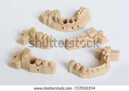  Upper and lower jaws dental bridge printed on 3D printer from a photopolymer material  on white background Stereolithography 3D printer, technology of liquid photopolymerization under UV light.