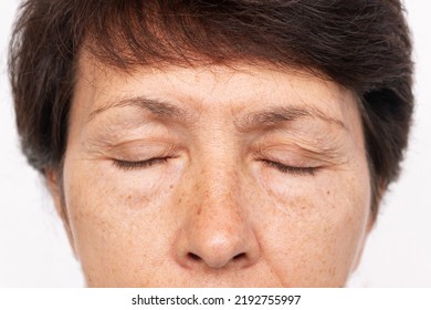 Upper part of elderly woman's face with signs of skin aging isolated on white background. Age-related changes, flabby sagging facial skin, wrinkles and creases on the eyelids and puffiness under eyes