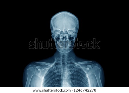 upper part of human body, hight quality x-ray image of human in blue tone on black background 