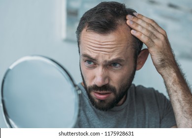 upset middle aged man with alopecia looking at mirror, hair loss concept 