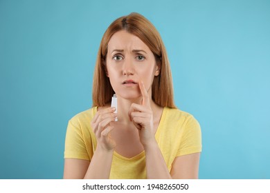 Upset Woman With Herpes Applying Cream On Lips Against Light Blue Background