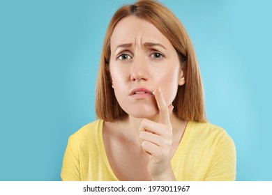 Upset Woman With Herpes Applying Cream On Lips Against Light Blue Background