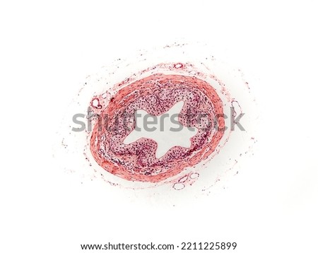 ureter cross section under the microscope - optical microscope x100 magnification
