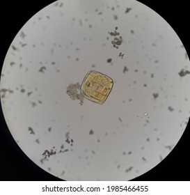 Uric Acid Crystals In Urine. 40X