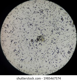 Uric Acid Crystals In Urine.10X