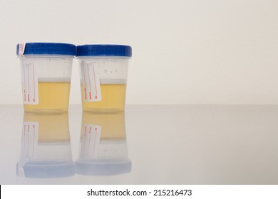 Urinalysis Drug Test