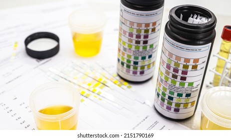 Urinalysis reagent strip used for ketosis control and 9 other parameters, EAS type urinalysis, Abnormal Sediment Elements
