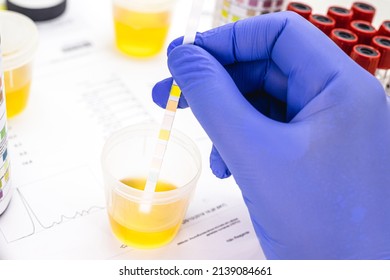 urinalysis with reagent strips to analyze Leukocytes, Urobilinogen, Bilirubin, Blood, Nitrite, pH, Density, Protein, Glucose and Ketosis bodies.