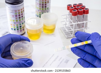 urinalysis with reagent strips to analyze Leukocytes, Urobilinogen, Bilirubin, Blood, Nitrite, pH, Density, Protein, Glucose and Ketosis bodies.