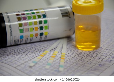 Urinalysis. Urine Cup And Urine Strip Test