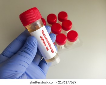 Urinalysis, Urine Sample For Phase Contrast Microscopy(PCM) Test, Close And Focus View.