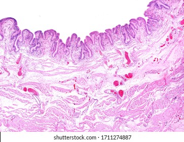Urinary bladder wall showing a very folded mucosa layer and a muscular layer with smooth muscle cells arranged in thin bundles separated by connective tissue septa with large blood vessels