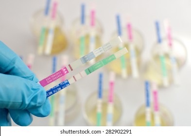 Urine Analysis By Using Test Strip