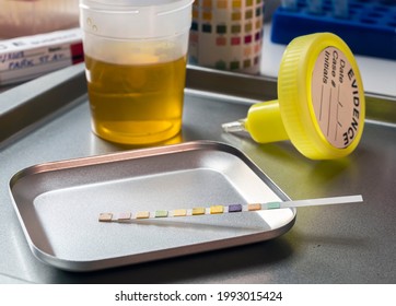 Urine Analysis Result Of Murder Suspect In Crime Lab, Concept Image