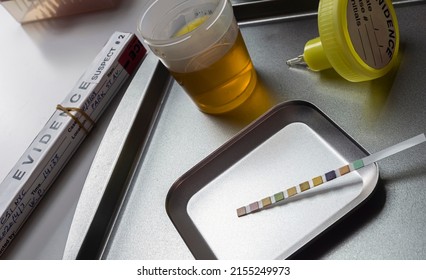 Urine Analysis Result Of Murder Suspect In Crime Lab, Concept Image