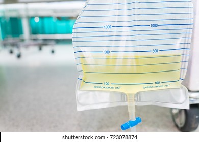 Urine bag hanging beside the patient's bed. Inside the hospital room.