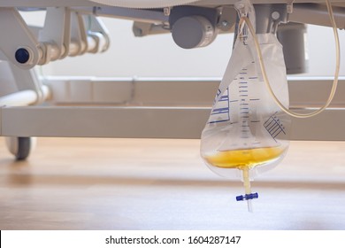 Urine bag hanging under patient bed in room at hospital. The patient has symptoms of lung flooding. The doctor treats by giving diuretics. Medical care equipment. Health care concept