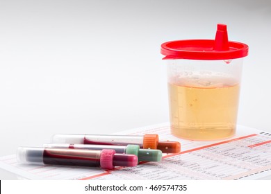 Urine And Blood Sample On A Form For Examination