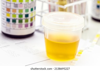 urine bottle, urinalysis to analyze Leukocytes, Urobilinogen, Bilirubin, Blood, Nitrite, pH, Density, Protein, Glucose and ketone bodies (ketosis)