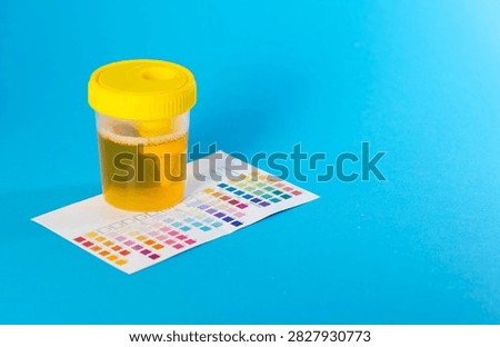 Urine container on a diagram for urine testing with rapid test strips, blue background. Determination of ketone bodies and bilirubin, leukocytes, and erythrocytes.