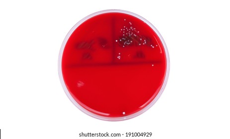 Urine Culture On Columbia Blood Agar, Left Is Negative And Right Is Positive With Enterococcus Faecalis