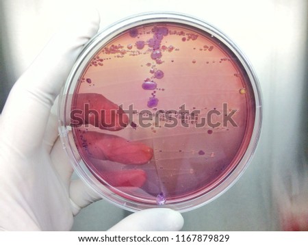 urine culture show gram