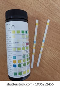 Urine Dipstick Test. This Is A Simple Bedside Urine Test To Check For Presence Of Urinary Tract Infection, Presence Of Blood In Urine, Or Presence Of Protein In Urine. 