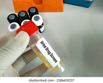 Urine Drug Screen Test Sample, Also Known As A Urine Drug Screening Painless Test It Analyzes Your Urine For The Presence Of Certain Illegal Drugs And Prescription Medications