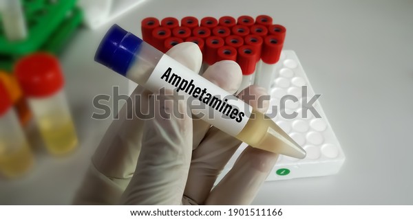 A urine drug test, also\
known as a urine drug screening painless test it analyzes your\
urine for the presence of certain illegal drugs and prescription\
medications