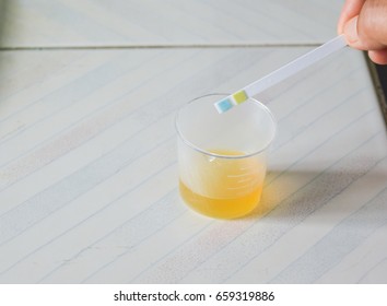 Urine Sugar Images Stock Photos Vectors Shutterstock