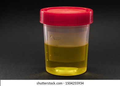 urine in a jar for analysis on a dark background