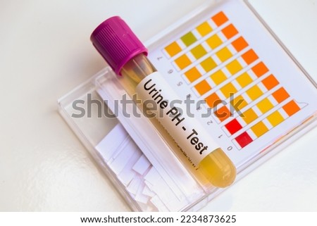 Urine PH test to look for abnormalities from Urine,  Urine sample to analyze in the laboratory, Urine in test tube