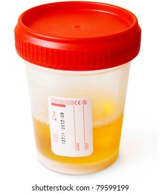 Urine Sample