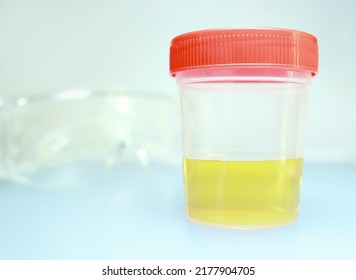 1,713 Urine study Images, Stock Photos & Vectors | Shutterstock