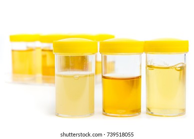 3,138 Urine sample bottle Stock Photos, Images & Photography | Shutterstock