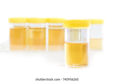 Urine Sample Bottles Isolated On White Stock Photo 741839350 | Shutterstock