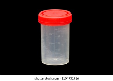 Urine Sample In Container Isolated On Black Background With Clipping Path, Bubble In Urine Specimen Mean Protein Found In A Urine Sample Known As Proteinuria, Determined By Urine Dipstick Test.