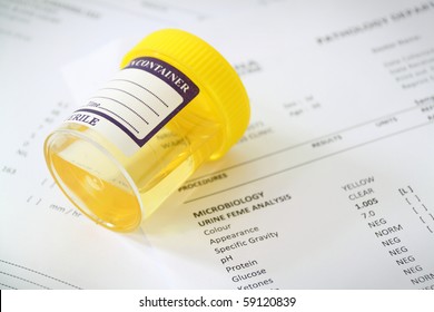 Urine Sample Container Over Medical Report Stock Photo 59120839 ...