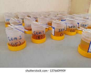 Urine sample in container with test strips