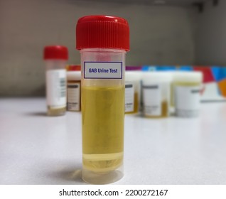 Urine Sample For GAB(Gabapentin) Urine Test. Set Therapeutic Dose. Epilepsy, Seizures.