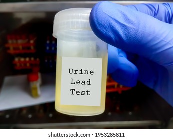 Urine Sample For Lead (pb) Test