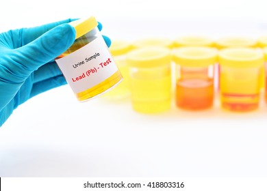 Urine Sample For Lead (Pb) Test
