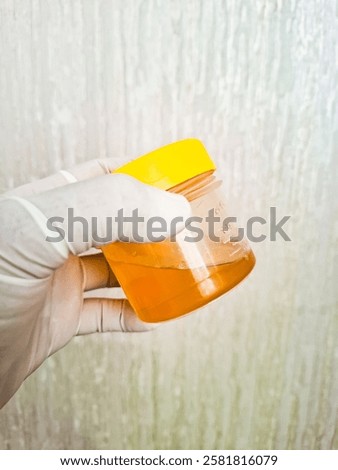 Urine sample in a urine sample pot, held with gloves. Urinalysis laboratory examination.